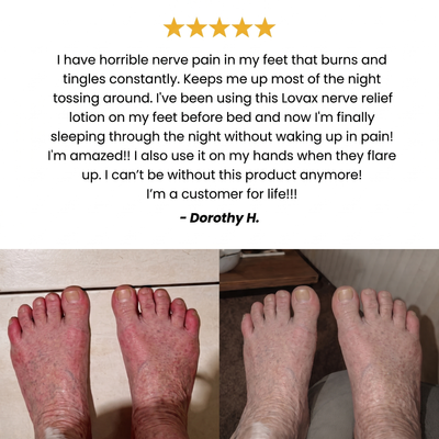Nerve Relief Lotion