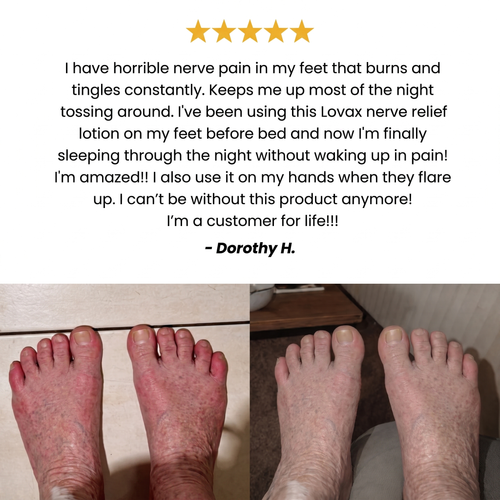 Nerve Relief Lotion