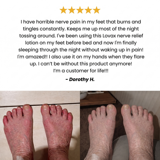 Nerve Relief Lotion